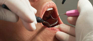 Dental checkup